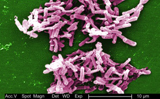 C. difficile bacteria: This is a micrograph of Gram-positive C. difficile bacteria from a stool sample culture.: Photograph courtesy of CDC